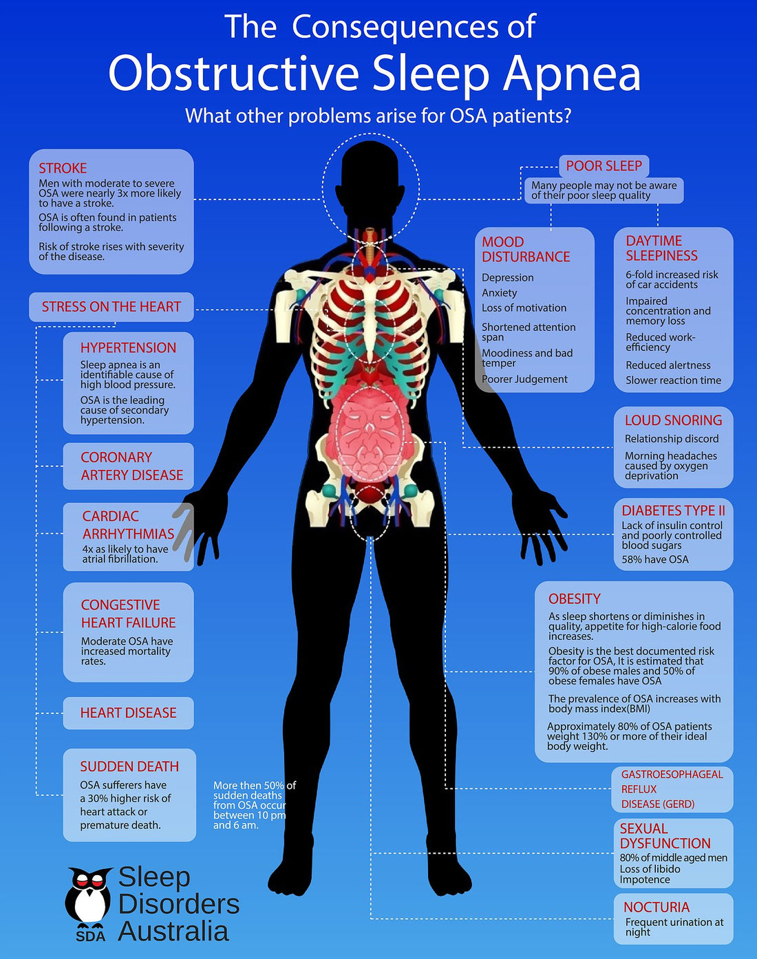 Obstructive Sleep Apnea Sleep Mate CPAP